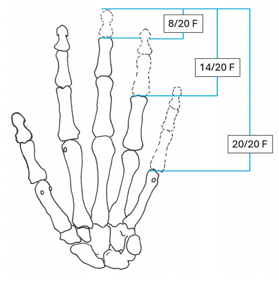Abbildung 5: Verlustwerte Langfinger (vgl. Tab. 2)