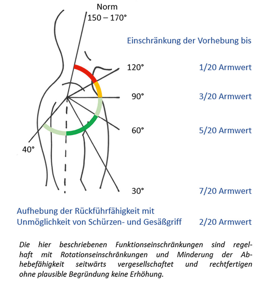 Abb. 14: Bewegungseinschränkung des Schultergelenks innerhalb der Gliedertaxe (vgl. Tab. 6)