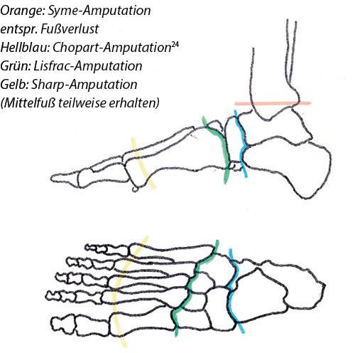 Abb. 15: Fußvoll- und –teilverlust (vgl. Tab. 11)