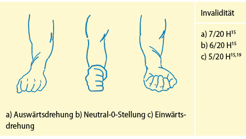 Abbildung 8: Aufhebung der Unterarmdrehung in verschiedenen Stellungen (vgl. Tab. 3)