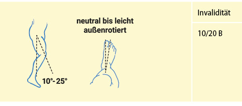 Abbildung 16: Versteifung Hüftgelenk in funktionsgünstiger Stellung (vgl. Tab. 12)
