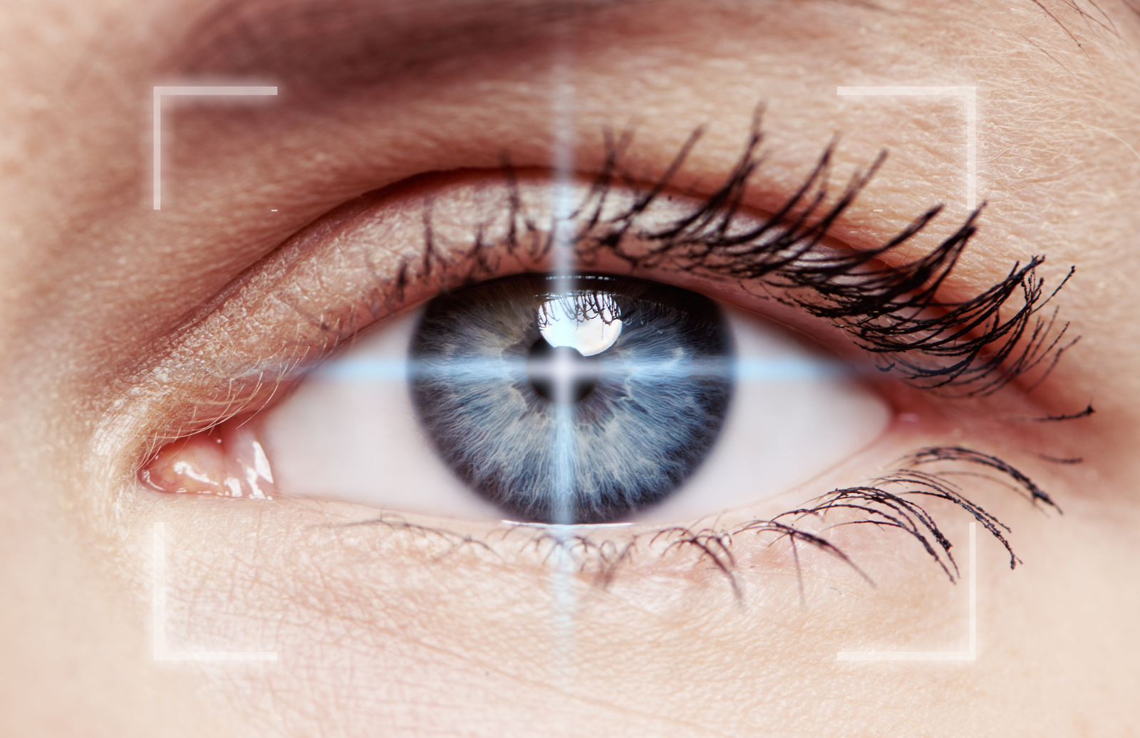 Zentralarterienverschluss ein ophthalmologischer Notfall
