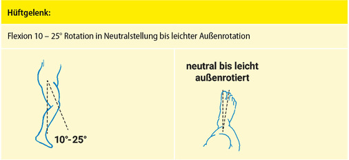 Abbildung 6: Funktionsgünstige Versteifung Hüftgelenk
