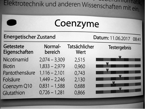 
Abb. 3: BioScan SWA Messung – Teilbefund 
