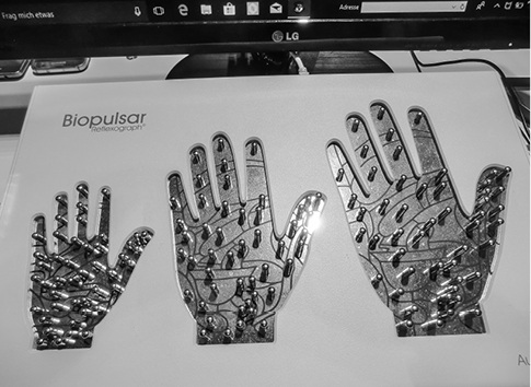 Abb. 4: Biopulsar-Reflexograph® – Handsensor
Abb. 4: Biopulsar-Reflexograph® – Handsensor