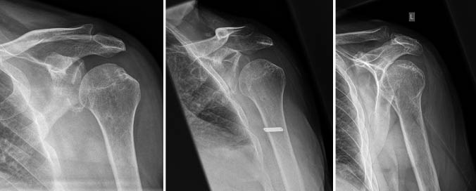 Abbildung 1 - © Bilder: Klinikum Pirna, Klinik für Radiologie
 Abbildung 1