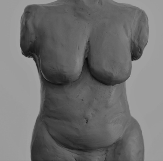 Abbildung 1 : Ton-Modellierung des Torsos einer Frau in mittlerem Lebensalter, leichte Makromastie und leichte Ptose der Brust