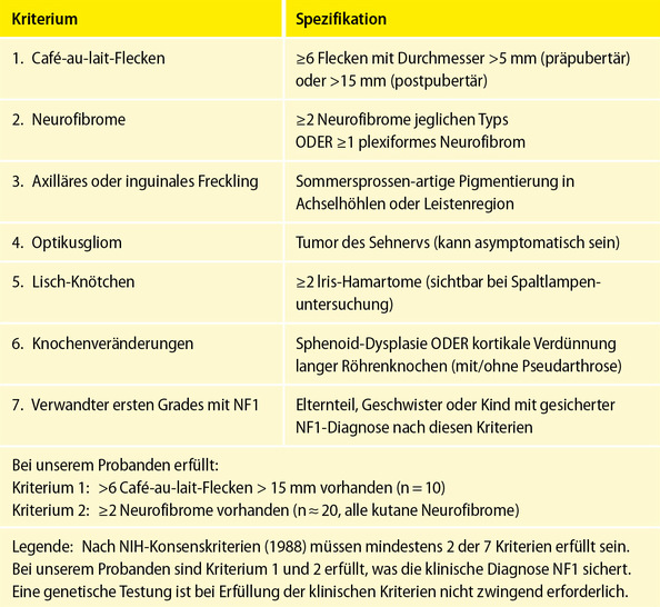 Tabelle 1: NF1 Diagnosekriterien